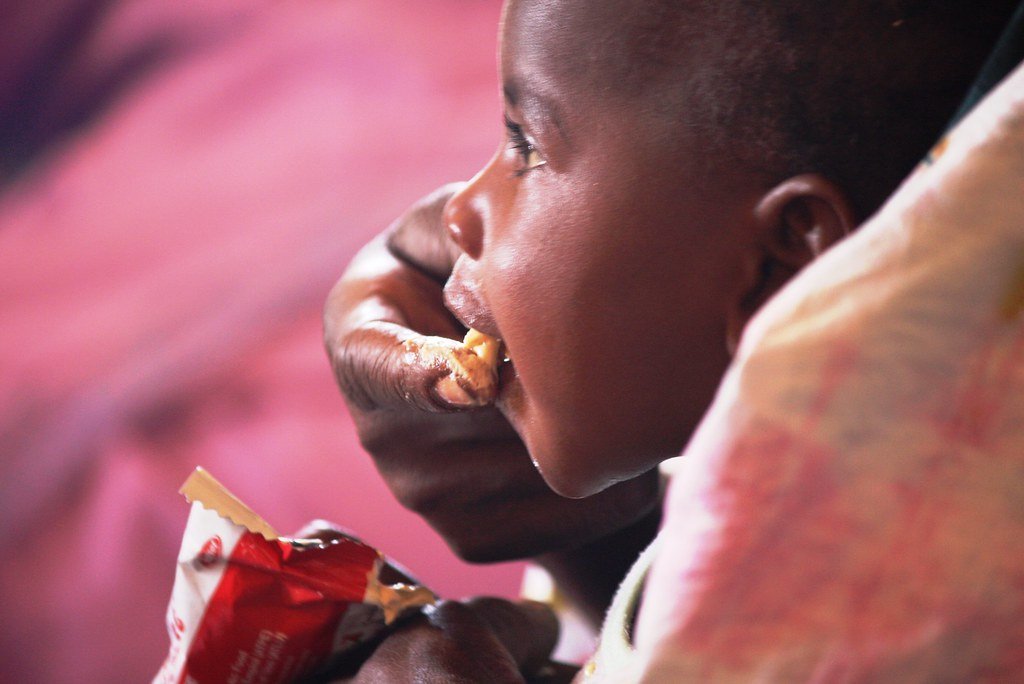 malnutrition difference between malnutrition and undernutrition define undernutrition malnutrition and undernutrition malnutrition undernutrition and overnutrition difference between undernutrition and overnutrition causes of undernutrition types of undernutrition chronic undernutrition undernutrition increases the risk of what conditions maternal undernutrition undernutrition and overnutrition are both problems in the united states undernutrition and overnutrition undernutrition and malnutrition undernutrition and malnutrition difference undernutrition and overnutrition difference undernutrition and malnutrition are same undernutrition and intestinal infections in children a narrative review undernutrition and overnutrition difference between undernutrition adalah acute undernutrition another word for undernutrition are malnutrition and undernutrition same adaptive response to undernutrition ano ang undernutrition acute undernutrition is related to acute vs chronic undernutrition adult undernutrition aspen undernutrition assessment of undernutrition undernutrition bmi undernutrition baby undernutrition bengali meaning undernutrition body both undernutrition and overnutrition are examples of undernutrition can be caused by undernutrition can be undernutrition in bengali undernutrition in bangladesh basic causes of undernutrition bmi undernutrition burden of undernutrition throughout the life cycle both overnutrition and undernutrition can lead to bengali meaning of undernutrition what is indicative of both over and undernutrition what do you mean by undernutrition undernutrition causes undernutrition child undernutrition classification undernutrition children undernutrition consequences what is undernutrition what is overnutrition and undernutrition consequences of undernutrition classification of undernutrition child undernutrition classification of undernutrition according to who causes of undernutrition in children causes of undernutrition and overnutrition complications of undernutrition can undernutrition cause diabetes undernutrition definition undernutrition diseases undernutrition definition pdf define undernutrition and overnutrition malnutrition undernutrition difference liver disease undernutrition screening tool undernutrition vs malnutrition definition malnutrition and undernutrition difference between difference between malnutrition undernutrition and overnutrition difference between overnutrition and undernutrition in points difference between malnutrition and undernutrition in points deficiency states malnutrition and undernutrition ppt diseases caused by undernutrition define malnutrition undernutrition and overnutrition undernutrition examples undernutrition effects undernutrition explain explain undernutrition protein energy undernutrition undernutrition meaning in english protein energy undernutrition peu difference between overnutrition and undernutrition effects of undernutrition example of undernutrition explain the term malnutrition and undernutrition explain the term undernutrition explain malnutrition and undernutrition effect of undernutrition throughout the life cycle effects of undernutrition in children example of undernutrition and overnutrition explain the difference between malnutrition and undernutrition undernutrition food undernutrition facts undernutrition forms undernutrition factors focus undernutrition fetal undernutrition fao undernutrition unicef undernutrition framework undernutrition risk factors undernutrition in french forms of undernutrition focus on undernutrition focus on undernutrition uk facts about undernutrition food insecurity and undernutrition factors contributing to undernutrition factors affecting undernutrition famine and undernutrition focus on undernutrition app undernutrition geography definition undernutrition graph undernutrition girl undernutrition globally glim undernutrition undernutrition meaning in gujarati prevalence of undernutrition globally undernutrition là gì global prevalence of undernutrition global undernutrition global burden of undernutrition gut microbiome development and childhood undernutrition gomez classification of undernutrition geospatial overlap of undernutrition and tuberculosis in ethiopia grades of undernutrition good nutrition undernutrition gut microbiota in obesity and undernutrition undernutrition hindi meaning undernutrition health problems undernutrition hindi undernutrition kya hota hai hunger and undernutrition undernutrition only happens in developing countries undernutrition definition health undernutrition definition hindi undernutrition meaning in hindi wikipedia how does undernutrition differ from malnutrition how does undernutrition affect the body hindi meaning of undernutrition how to prevent undernutrition health problems associated with undernutrition how is malnourishment different to undernutrition how does undernutrition impact the children how to treat undernutrition how is malnutrition different from undernutrition explain how to fix undernutrition undernutrition increases the risk of undernutrition in adults undernutrition increases the risk of what conditions in older adults is undernutrition and malnutrition the same icd 11 undernutrition icd 10 undernutrition is undernutrition a word indicators of undernutrition is undernutrition a disease impact of undernutrition immediate cause of undernutrition indicators of undernutrition in children iap classification of undernutrition justify the statement malnutrition is different from undernutrition undernutrition kids undernutrition ka hindi undernutrition kannada meaning undernutrition kwashiorkor undernutrition also known as undernutrition in kannada undernutrition kya hai kode icd 10 undernutrition undernutrition meaning in kannada undernutrition meaning in khasi undernutrition key characteristics undernutrition in kenya undernutrition leads to undernutrition can lead to quizlet undernutrition diseases list what does undernutrition lead to what does undernutrition look like long term undernutrition long term effects of undernutrition later signs and symptoms of undernutrition include lancet series on maternal and child undernutrition lancet series on maternal and child undernutrition 2021 what leads to undernutrition what is a likely nutrient deficiency for undernutrition undernutrition meaning undernutrition meaning in hindi undernutrition meaning in tamil undernutrition meaning in marathi undernutrition meaning in bengali undernutrition malnutrition undernutrition may occur as a result of decreased nutritional intake malnutrition vs undernutrition malnutrition and undernutrition difference meaning of undernutrition macronutrient undernutrition malnutrition undernutrition and overnutrition ppt micronutrient undernutrition malnutrition is indicative of both over and undernutrition undernutrition ncbi undernutrition nhs undernutrition nursing care plan undernutrition notes undernutrition definition nutrition undernutrition in nigeria undernutrition short note undernutrition in nutrition undernutrition does not include undernutrition occurs when nutrient intake nfhs 5 undernutrition nutrition and undernutrition negative effects of undernutrition nhs undernutrition which of the following is not a sign of undernutrition short note on undernutrition undernutrition or undernutrition another name for undernutrition over nutrition and undernutrition undernutrition occurs when undernutrition overnutrition undernutrition of vitamins and minerals undernutrition other term undernutrition obesity undernutrition vs overnutrition malnutrition or undernutrition overnutrition and undernutrition overnutrition and undernutrition are part of what continuum undernutrition and overnutrition are both forms of overnutrition and undernutrition difference overnutrition and undernutrition pdf over and undernutrition obesity and undernutrition opposite of undernutrition overnutrition undernutrition and malnutrition undernutrition picture undernutrition ppt undernutrition pdf undernutrition prevention undernutrition pronunciation undernutrition prevalence undernutrition philippines undernutrition person undernutrition pathophysiology undernutrition problem tree prevention of undernutrition prevalence of undernutrition protein undernutrition picture of undernutrition pathophysiology of undernutrition poverty and undernutrition prevalence of undernutrition in india pem undernutrition what is the primary cause of global undernutrition quizlet undernutrition results in a reduction in the body's reserves of undernutrition results in undernutrition refers to undernutrition risks undernutrition related diseases undernutrition rate in india undernutrition recovery recurrent undernutrition undernutrition can result from which of the following risk of undernutrition risk factors for undernutrition risk increased by undernutrition reasons for undernutrition results of undernutrition revisiting maternal and child undernutrition the highest rates of undernutrition are found in undernutrition symptoms undernutrition synonym undernutrition slideshare undernutrition signs and symptoms undernutrition signs severe undernutrition malnutrition and undernutrition same female underweight/undernutrition syndrome symptoms of undernutrition signs and symptoms of undernutrition severe maternal undernutrition show the difference between undernutrition and overnutrition stunting undernutrition stunting is a result of undernutrition particularly from inadequate synonyms of undernutrition secondary undernutrition undernutrition treatment undernutrition types undernutrition tamil meaning undernutrition in the philippines explain the undernutrition define the undernutrition undernutrition and malnutrition the same treatment of undernutrition types of undernutrition in children the difference between malnutrition and undernutrition the consequences of undernutrition are most critical during the leading cause of undernutrition in the united states is the term undernutrition refers to people who consume tb and undernutrition the meaning of undernutrition undernutrition unicef undernutrition in uk undernutrition underweight unrecognised undernutrition may detrimentally impact on unspecified undernutrition undernutrition vs underweight undernutrition in uganda undernutrition meaning in urdu undernutrition wasting stunting underweight unicef framework for maternal and child undernutrition undernourishment and undernutrition undernourishment vs undernutrition unicef conceptual framework of undernutrition unicef undernutrition underlying causes of undernutrition underweight and undernutrition undernutrition vs malnutrition undernutrition verb malnutrition vs undernutrition vs overnutrition mal vs undernutrition what is undernutrition very short answer vicious cycle of undernutrition vicious cycle of undernutrition and infection chronic undernutrition vs malnutrition undernutrition who undernutrition who definition undernutrition wasting undernutrition wikipedia undernutrition weight undernutrition worldwide undernutrition wasting or stunting undernutrition word when undernutrition occurs which one of the following risks is increased by undernutrition what's the difference between undernutrition and malnutrition what is undernutrition and overnutrition which of the following is true of undernutrition and tb write a cause of undernutrition what does undernutrition mean who classification of undernutrition what is malnutrition and undernutrition what is the difference between undernutrition and overnutrition what causes undernutrition what do you understand by undernutrition undernutrition z score z score for undernutrition undernutrition icd 10 undernutrition icd 11 icd 11 undernutrition in adults severe undernutrition icd 10 icd 11 code undernutrition 2 types of undernutrition undernutrition in the philippines 2024 3 types of undernutrition 3 cardinal determinants of undernutrition 4 types of undernutrition 4 causes of undernutrition 4 known causes of undernutrition 5b72 undernutrition in adults 5 types of undernutrition malnutrition is different from undernutrition how class 5 what is undernutrition.. class 6 what is undernutrition class 8 write a cause of undernutrition class 8 what leads to undernutrition class 8 what is undernutrition class 9