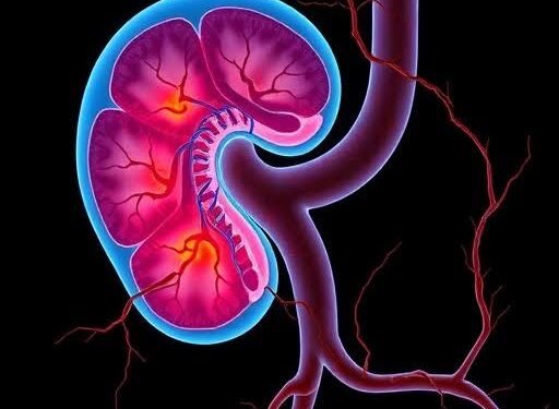 kidney what causes kidney stones chronic kidney disease polycystic kidney disease signs of kidney failure stage 3 kidney disease kidney stones symptoms of kidney problems what is the first sign of kidney problems acute kidney injury signs of kidney problems kidney anatomy kidney and liver detox kidney anatomy diagram kidney and liver cleanse kidney autoimmune disease kidney and hypertension center kidney area kidney atrophy about kidney function about kidney stones about kidney disease a kidney disorder that occurs in diabetic nephropathy is a diagram of a kidney are kidney beans about kidney failure about chronic kidney disease kidney bean recipes kidney biopsy kidney beans nutrition kidney bean salad kidney blood test kidney bean salad recipe kidney biopsy procedure kidney beans benefits kidney back pain bill cody heart kidney failure best antibiotic for kidney infection bad food for kidney blood test for kidney function best food for kidney health back pain vs kidney pain benefits of kidney beans blood test for kidney biopsy of kidney beans kidney kidney cancer symptoms kidney cancer kidney cyst kidney cleanse kidney cancer survival rate kidney cancer treatment kidney cyst symptoms kidney cop kidney care kidney cancer prognosis chronic kidney disease symptoms causes of kidney stones cyst on kidney chronic kidney disease stage 3 causes of kidney failure can kidney stones kill you can you live with one kidney can kidney disease be reversed cortical cyst in kidney kidney disease kidney disease symptoms kidney doctor kidney disease in cats kidney dialysis kidney disease stages kidney doctor near me kidney disease in dogs kidney diet kidney detox duplex kidney diagram of kidney doctor for kidney doctor of kidney is called dialysis kidney detox kidney dogs with kidney disease disease of kidney damage kidney symptoms dogs kidney failure kidney en espanol kidney enzymes kidney egfr kidney enzymes high kidney emoji kidney experts kidney endometriosis kidney excretion kidney enlargement kidney embolization ectopic kidney early signs of kidney disease early symptoms kidney cancer warning end stage kidney disease early signs of kidney stones early signs of kidney failure early signs of kidney problems end stage kidney failure enlarged kidney early signs kidney damage kidney failure symptoms kidney failure kidney function kidney function test kidney failure in dogs kidney friendly diet kidney failure stages kidney foundation kidney failure in cats kidney friendly foods fresenius kidney care function of kidney for kidney stone first sign of kidney problems for kidney disease failure kidney for kidney function test failure kidney symptoms for kidney pain for kidney infection kidney gfr kidney glomerulus kidney glomeruli kidney grills bmw kidney grill kidney gland kidney group kidney guard gujarat kidney ipo gmp gfr kidney georg böhmig kidney transplant study gold kidney health plan gallstones vs kidney stones green poop kidney infection gujarat kidney and superspeciality hospital ipo gujarat kidney ipo gmp today good food for kidney gujarat kidney share price kidney health kidney healthy diet kidney health supplements kidney healthy foods kidney health evaluation for patients with diabetes kidney hydronephrosis kidney hurts kidney health foods kidney health diet kidney histology horseshoe kidney how to test kidney function how much is kidney dialysis how is kidney stone pain how kidney function how is kidney pain how are kidney stones causes how much are kidney stones how to kidney failure symptoms how to treatment kidney stone kidney infection kidney infection symptoms kidney in spanish kidney infection symptoms in women kidney issues symptoms kidney infection causes kidney issues kidney infection treatment kidney infection antibiotics kidney infection vs uti infection in kidney infection in kidney symptoms is kidney disease is chronic kidney disease is it kidney pain is kidney stone in kidney stone symptoms in kidney disease symptoms is kidney failure is kidney cancer kidney jokes kidney job kidney juice kidney jamaican dish kidney jokes for adults kidney jing deficiency kidney juice recipe kidney jaundice kidney jing jesse eisenberg kidney jardiance for kidney disease jga kidney joey kidney jesse eisenberg kidney donation juice for kidney health jardiance kidney function just remember joey kidney juice for kidney detox jobs at davita kidney care kidney kitchen kidney kindness tea kidney kitchen potassium food guide kidney kidney kidney kitchen recipes kidney ketosis kidney ketones kidney creatinine kidney kids kidney stone in kidney kidney stone in kidney symptoms kidney beans for kidney kidney stone pain in kidney kidney stone in kidney treatment kidney kidney disease kidney failure kidney kidney kidney diagram kidney kidney disease symptoms kidney function of kidney kidney location in body kidney location kidney location in back kidney location in the human body kidney levels kidney labs kidney lesion kidney labeled kidney lab tests kidney levels high left kidney pain symptoms left kidney pain low kidney function location of kidney liver and kidney life expectancy after kidney removal low potassium foods for kidney patients liver and kidney detox location of kidney in human body location of kidney pain kidney medications kidney medicine kidney medications list kidney mass kidney medical term kidney meridian kidney mass icd 10 kidney medulla kidney mass symptoms kidney medications names medullary sponge kidney metastatic kidney cancer multicystic dysplastic kidney mild hydronephrosis in left kidney medicine to break up kidney stones mustika dewa side effects kidney maximum life after kidney transplant medicine for kidney stones mass on kidney medical term for kidney stones kidney nephron kidney numbers kidney nephrosis kidney nodule kidney news kidney nephritis kidney numbers low kidney not functioning properly kidney nutrition institute kidney nephron diagram national kidney foundation normal kidney size national kidney and transplant institute normal kidney size in cm by age normal kidney size in cm nephrons in kidney normal kidney function percentage by age nadiad kidney hospital nodosis 500 for kidney normal kidney ultrasound kidney or back pain kidney on body kidney on right or left side kidney or bladder stones kidney obstruction kidney organ kidney organ system kidney pain kidney on ultrasound kidney or muscle pain of kidney stones of kidney failure of kidney failure symptoms of kidney disease on a blood test what is kidney function of a kidney infection on kidney dialysis of kidney stones symptoms of chronic kidney disease of kidney problems kidney pain location kidney pain vs back pain kidney problems symptoms kidney pain symptoms kidney problems kidney pain vs lower back pain kidney pain causes kidney pain location female pig kidney transplant polycystic kidney pain in kidney area picture of kidney prevent kidney stones pain in kidney pain in left kidney position of kidney in the body pain of kidney stone kidney qi deficiency kidney qi deficiency symptoms kidney qi kidney quadrant kidney qi deficiency treatment kidney quiz kidney que es kidney quotes kidney quiz questions and answers quick soak kidney beans quinoa good for kidney patients quaker oats good for kidney quinoa kidney friendly quinoa for kidney patient qualifications to donate a kidney quercetin kidney quinoa and kidney health quickest way to pass kidney stones quinoa benefits for kidney kidney removal surgery kidney reflux kidney removal kidney repair kidney rash kidney removal surgery recovery kidney removal surgery name kidney related kidney replacement kidney related crossword clue red kidney beans right kidney pain location right kidney pain symptoms right kidney pain right kidney normal size in cm red kidney beans recipe right kidney red kidney beans benefits riley kidney removal of kidney kidney stone symptoms kidney stones treatment kidney stone pain kidney stones causes kidney stone symptoms in women kidney stone pain location kidney stone surgery kidney specialist kidney stone symptoms in men symptoms of kidney stones symptoms of kidney disease symptoms of kidney failure signs of kidney stones symptoms of kidney infection signs of kidney disease kidney transplant kidney tests kidney transplant surgery kidney transplant waiting list by state kidney table kidney table for classroom kidney transplant recovery kidney tumor kidney tea kidney transplant icd 10 treatment for kidney stones test for kidney function the kidney diagram the function of kidney the symptoms of kidney failure the symptoms of kidney disease the symptoms of kidney stones the signs of kidney failure the symptoms of kidney problem the signs of kidney problems kidney ultrasound kidney ultrasound prep kidney ureter kidney urine test kidney ultrasound images kidney ultrasound procedure kidney ureter bladder kidney ulcer kidney ultrasound cpt code kidney ultrasound findings uric acid kidney stones uti vs kidney infection uti kidney infection urine test for kidney function uti vs kidney stone ultrasound kidney ultrasound for kidney stones ultrafiltration in kidney uti kidney infection symptoms uti kidney pain kidney vs liver kidney vitamins kidney vs back pain kidney vs liver function kidney values kidney vs pinto beans kidney vs bladder infection kidney values in dogs kidney vs pinto beans in chili kidney vs liver pain vitamins for kidney health vitamins for kidney repair vasa recta kidney vegetables to avoid for kidney stones vitamins for kidney variety of kidney bean crossword clue vitamin d and kidney stones vegetables for kidney patients vegetables good for kidney vuj in kidney kidney walk 2026 kidney week 2026 kidney wood tea kidney week kidney walk kidney wood benefits kidney worm kidney wiki kidney wood tree what are kidney stones what is kidney disease what is chronic kidney disease what are the symptoms of kidney stones what are the symptoms of kidney failure where is kidney pain what is stage 3 kidney disease what are the symptoms of kidney disease kidney xray kidney xenotransplantation kidney xray images kidney xgp kidney x ray with contrast kidney x empower kidney xenotransplantation 2026 kidney x prize xgp kidney x ray for kidney stones xenotransplantation kidney xray of kidney xray kidney stone xarelto and kidney function xanax and kidney disease xvivo kidney assist xanthogranulomatous kidney xgp kidney disease kidney yang deficiency kidney yin deficiency symptoms kidney yin deficiency kidney yang deficiency symptoms kidney yin deficiency with empty heat kidney yang deficiency treatment kidney yang kidney yin and yang deficiency symptoms kidney yin kidney yin deficiency treatment yoga for kidney health yoga for kidney stones yoga for kidney yogurt for kidney patients yoga for kidney creatinine yogurt good for kidney yogurt good for kidney patients your kidney you can live with one kidney yam good for kidney patients kidney zombie cells zenith medical and kidney centre ziemba sisters kidney stone zepbound and kidney function zolpidem side effects on kidney zepbound kidney issues zepbound and kidney stones zepbound kidney pain zyrtec and kidney disease zepbound and kidney disease zenith medical and kidney center abuja address kidney 0.9 kidney 0ain kidney 0 function kidney 0.7 kidney 0.1 kidney 0.5 0.3 kidney stone 0.4 kidney stone 0.6 kidney stone 0.4 cm kidney stone 0.5 cm kidney stone 0.6 cm kidney stone 0.3 cm kidney stone 0.7 cm kidney stone 0.8 cm kidney stone 0.9 cm kidney stone 0.2 cm kidney stone 0.5 mm kidney stone 0.6 cm kidney stone picture kidney 1 acupuncture point kidney 10 acupuncture point kidney 10 kidney 1 point kidney 13 acupuncture point kidney 16 acupuncture point kidney 1.3 kidney 1.4 kidney 1 acupuncture point benefits 10 mm kidney stone picture 10mm kidney stone 11mm kidney stone 10 cm cyst on kidney 12mm kidney stone 12 mm kidney stone image 1 cm kidney stone 14mm kidney stone 13 mm kidney stone picture 13mm kidney stone kidney 27 acupuncture point kidney 2 acupuncture point kidney 27 kidney 21 acupuncture point kidney 24 acupuncture point kidney 25 acupuncture point kidney 24 hour urine test kidney 22 acupuncture point kidney 23 acupuncture point 2mm kidney stone 2.5 cm mass on kidney 2.5 mm kidney stone 2 cm kidney stone 2mm kidney stone treatment 20 kidney function 2 kidneys 2026 world kidney day 2026 world kidney day theme 2025 kidney walk kidney 3 acupuncture point kidney 360 kidney 3b kidney 3a kidney 3b stage kidney 360 impact factor kidney 3b disease kidney 3a disease kidney 360 journal 3mm kidney stone 3a kidney disease 3b kidney disease 3 mm kidney stone treatment 3rd stage kidney disease 3a chronic kidney disease 3mm kidney stone size 3 mm kidney stone image 3b chronic kidney disease 3.5 mm kidney stone picture kidney 4 acupuncture point kidney 4 stage kidney 4th stage kidney 48 percent kidney 4 function kidney 40 percent kidney 400x labeled kidney 4 point kidney 44 4 methods for kidney stone removal 4mm kidney stone 4.5 mm kidney stone 4mm kidney stone picture 4 mm kidney stone treatment 4mm kidney stone size 4.2 mm kidney stone 4.7 mm kidney stone 4.8 mm kidney stone 4.4 mm kidney stone kidney 5 acupuncture point kidney 5k kidney 5k run kidney 5 stage kidney 50 percent function kidney 59 kidney 5.7 kidney 5 percent function kidney 5th stage 5mm kidney stone 5 mm kidney stone image 5mm kidney stone treatment 5.5 mm kidney stone 5mm kidney stone size 5.4 mm kidney stone 5 stages of kidney disease 5.6 mm kidney stone 5.2 mm kidney stone 5.8 mm kidney stone kidney 6 acupuncture point kidney 6 acupuncture point location kidney 6 point kidney 6 acupressure point kidney 60 gfr kidney 60 kidney 6 location kidney 6 pressure point kidney 6 acupuncture point benefits 6mm kidney stone 6 mm kidney stone size image 6mm kidney stone size 6mm kidney stone treatment 6.5 mm kidney stone 6.6 mm kidney stone 6.2 mm kidney stone 6.5 mm kidney stone image 6.4 mm kidney stone 6.7 mm kidney stone kidney 7 acupuncture point kidney 7 acupuncture point location kidney 70 function kidney 7 point kidney 79 kidney 7 function kidney 70 damage kidney 7mm stone kidney 70 7 functions of the kidney 7mm kidney stone 7mm kidney stone size 7.5 mm kidney stone 7mm kidney stone treatment 7 functions of the kidney in hindi 7mm kidney stone image 7.5 mm kidney stone image 7.2 mm kidney stone 7.8 mm kidney stone kidney 8 acupuncture point kidney 8 function kidney 80 function 8mm kidney stone 8 mm kidney stone image 8mm kidney stone size 8mm kidney stone treatment 84 year old kidney donor 8.5 mm kidney stone 8 golden rules for kidney health 8cm kidney stone 8mm kidney stone size chart 8.6 mm kidney stone kidney 9 acupuncture point kidney 9 acupuncture point location kidney 9 location kidney 9 point kidney 90 kidney 9 acupressure kidney 9 function kidney 9.2 cm kidney 9 beautiful baby point 9mm kidney stone 9mm kidney stone image 9mm kidney stone size 9mm kidney stone treatment 9.5 mm kidney stone 9.5 mm kidney stone image 9 millimeter kidney stone 9mm cyst on kidney 9 cm kidney stone 9.8 mm kidney stone